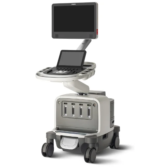 Produktfoto des Ultraschallsystems EPIQ CVx von Philips